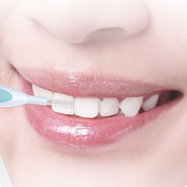 Tehnologia Buletedan